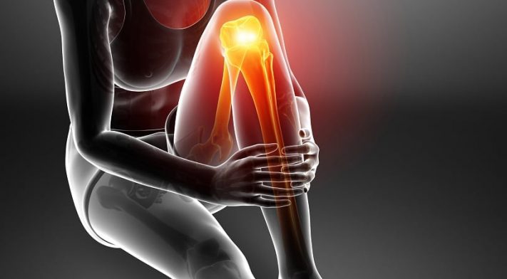 Prévenir les blessures et les douleurs au genou | Ultimateknees™