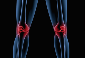 Quelle est la meilleure orthèse du genou?